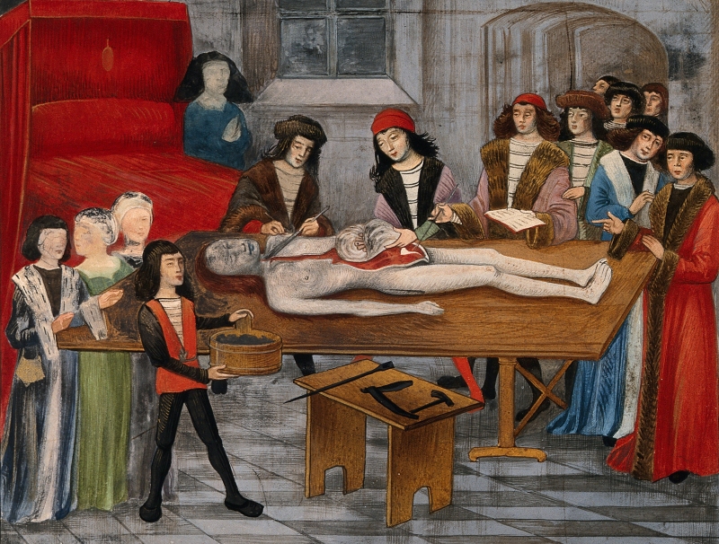 Post-mortem of a woman, 15th century manuscript illustration, Wikimedia Commons